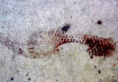 Bloody footprint by Willard