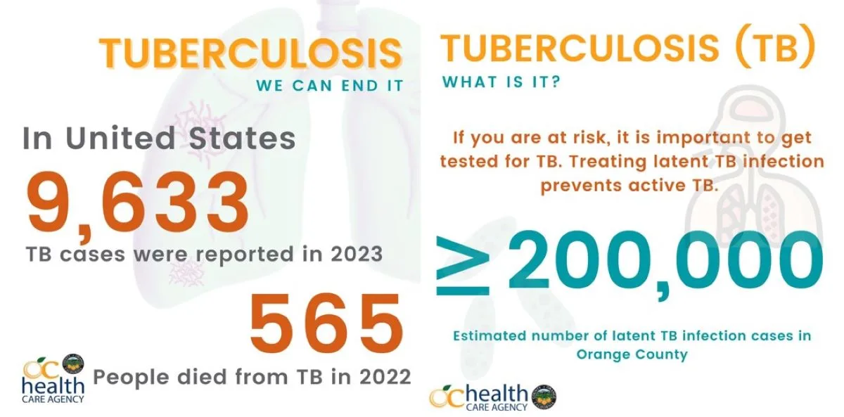 There are about 200000 OC residents who have latent tuberculosis